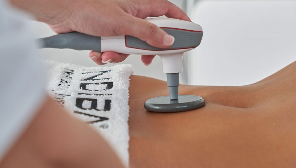 インディバの施術